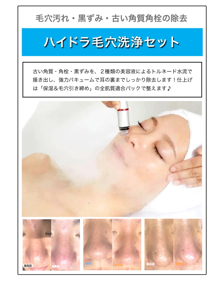ハイドラ毛穴洗浄